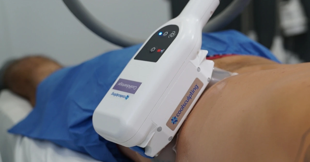CoolSculpting Treatment on Flanks