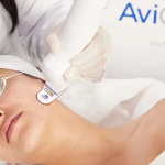 How Long Does AviClear Last?