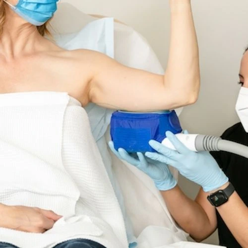 CoolSculpting Treatment for Underarm