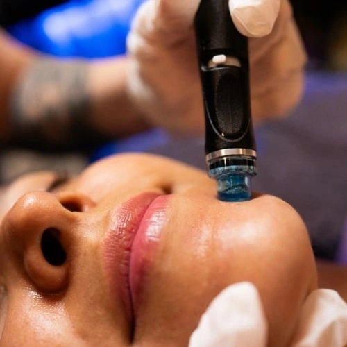 Woman having a HydraFacial Treatment