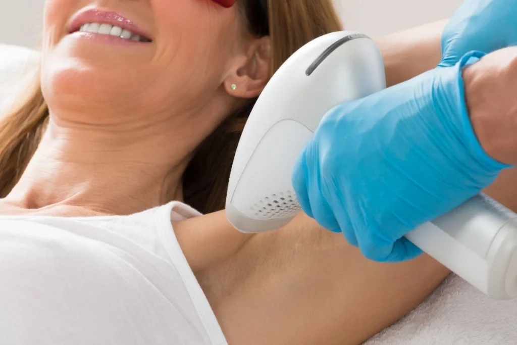 Woman having a laser hair removal treatment on her underarms.