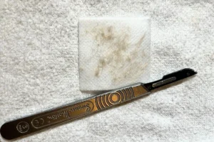 A dermaplane blade next to dead skin and hair that was removed during a professional dermaplaning treatment