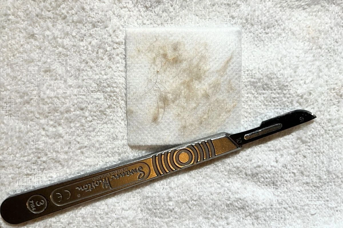 A dermaplane blade next to dead skin and hair that was removed during a professional dermaplaning treatment
