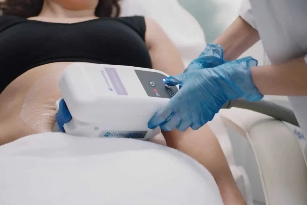 Woman having CoolSculpting Treatment on her Abdomen in Scottsdale, AZ.
