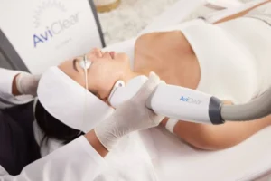 Woman having AviClear Treatment