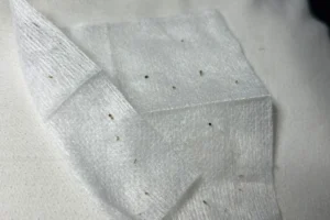 A cloth with Blackheads removed during facial at Collab Medspa