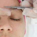 Will Dermaplaning Make My Hair Grow Back Thicker or Darker?