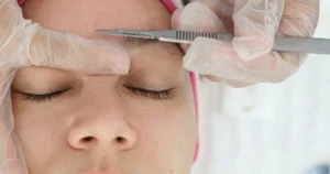 Woman having a dermaplane treatment