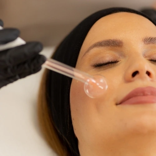 Woman having a high frequency treatment on her face at Collab Medspa