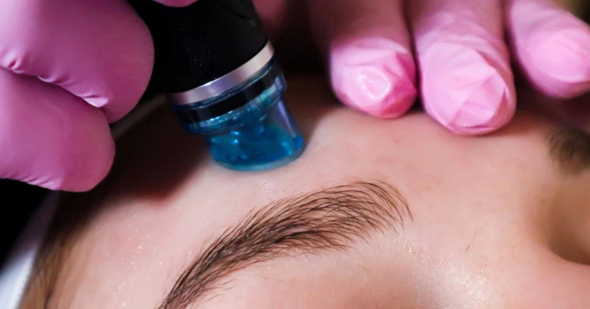 Woman having a HydraFacial Treatment done on her forehead