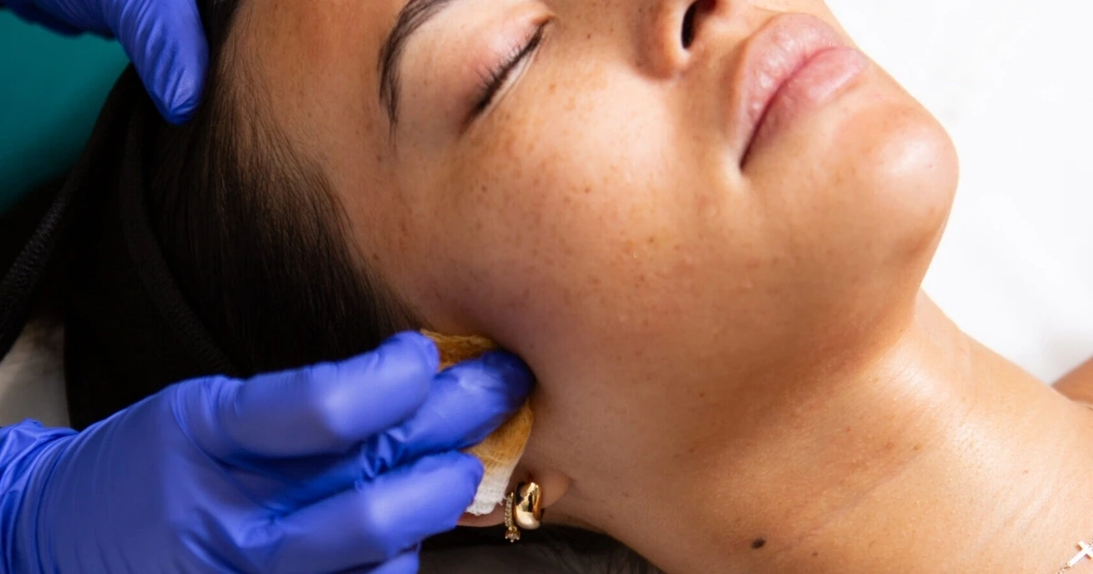 Woman with darker skin tone getting a VI Peel treatment in Scottsdale