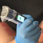 How Does Microneedling Work?