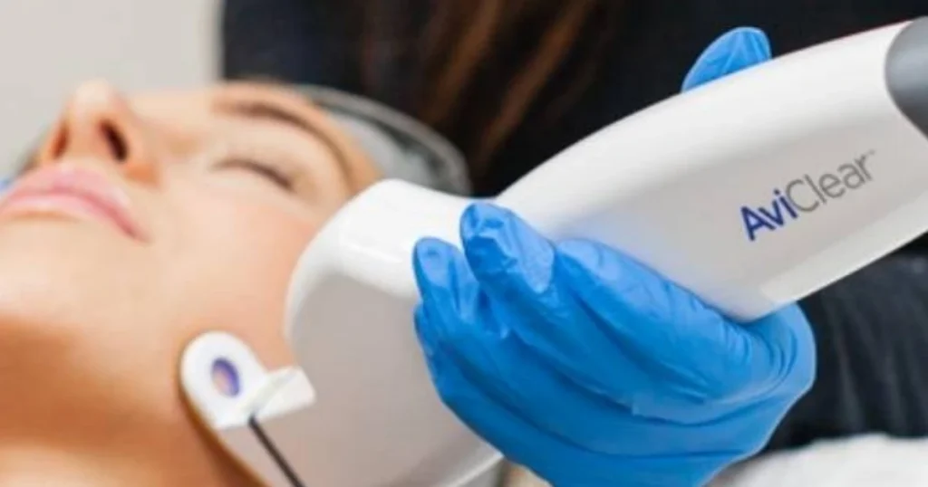 Woman having an AviClear treatment