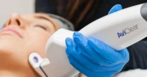 Woman having an AviClear treatment