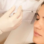 What Is Preventative Botox? And When Should You Start?