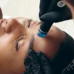 What Is a HydraFacial? Understanding the Steps, Benefits, and What to Expect