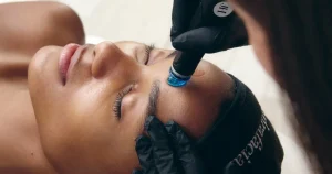 Woman having a HydraFacial Treatment